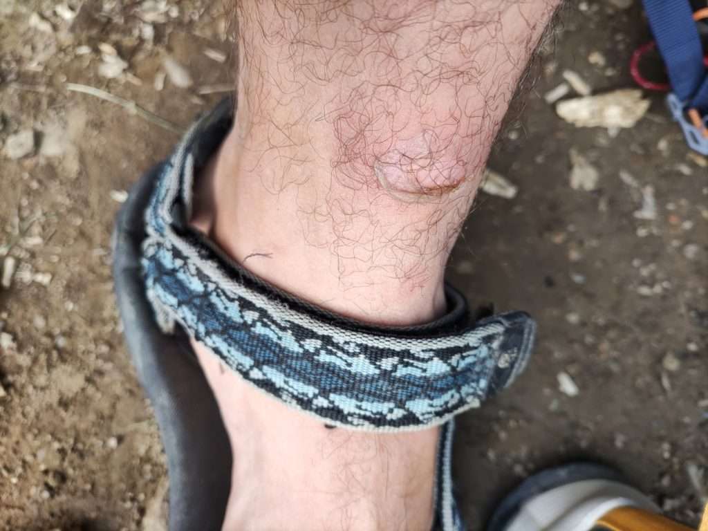 Blister on heel from initial break-in period with the Quest Element GTX